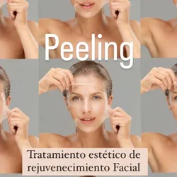 Peeling 