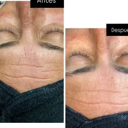 Tratamiento facial personalizado 