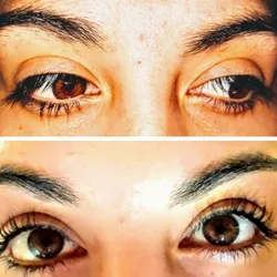 Lash lifting 