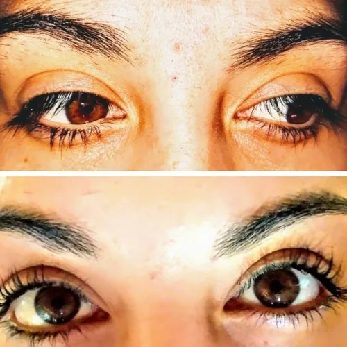 Lash lifting 