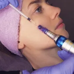 Renovación Facial Intensiva: Dermapen✨️