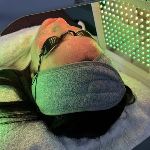 Limpieza facial  express 