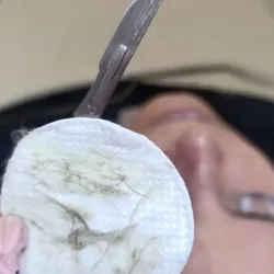 Dermaplaning + Limpieza Facial Profunda