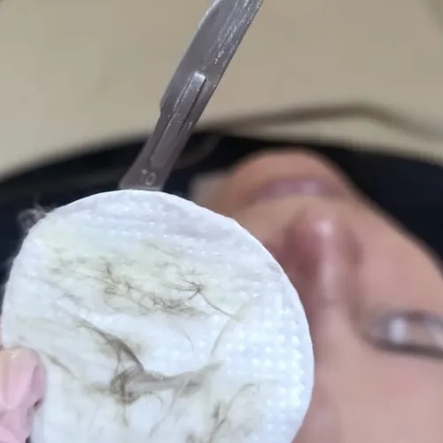 Dermaplaning + Limpieza Facial Profunda