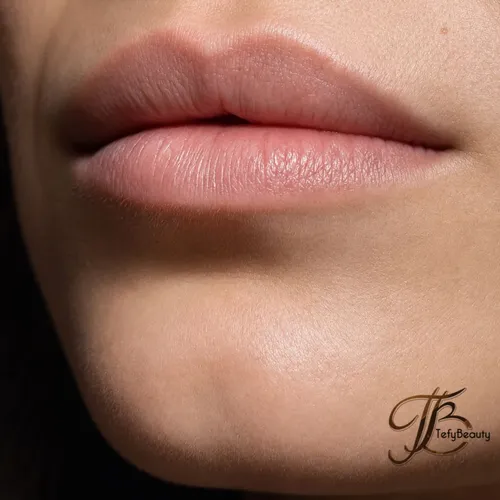 Depilación Facial (rostro completo)