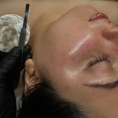 Dermaplaning, de Malena Skin