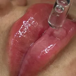 HydraLips