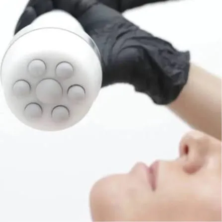 Crioradiofrecuencia Facial 