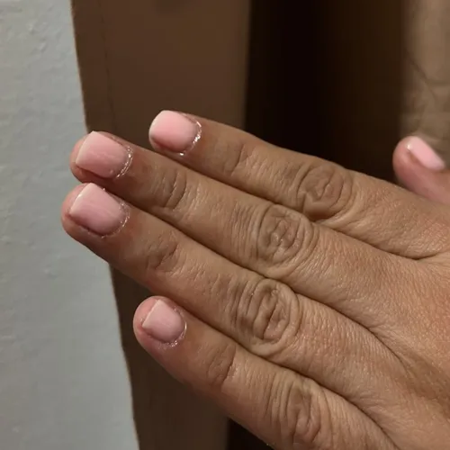 Kapping gel