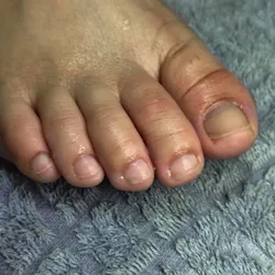 Pedicuria 