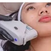 Hifu (lifting) facial 