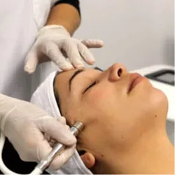 MICRODERMOABRACIÓN