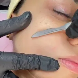 Dermaplanig ✨