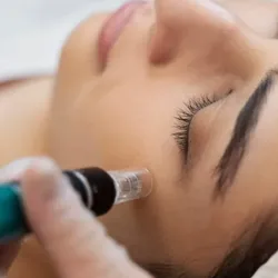 Facial Dermapen con exosomas: regeneración, manchas, arrugas, etc.