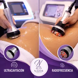 Promo Pack 4 sesiones Ultracavitacion Radiofrecuencia y Ondas Rusas