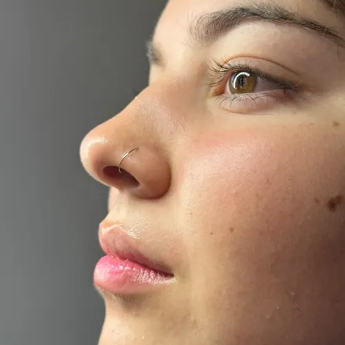 HIGIENE FACIAL PROFUNDA + ACTIVOS+ HIDRALIPS