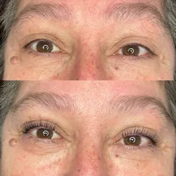 Lash lifting 
