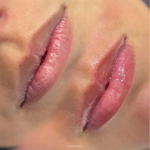 RENEW LIPS