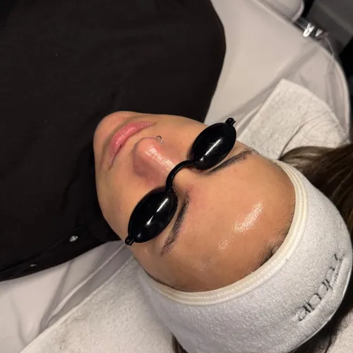 LIMPIEZA PROFUNDA + PEELING EN PROMO ⭐️