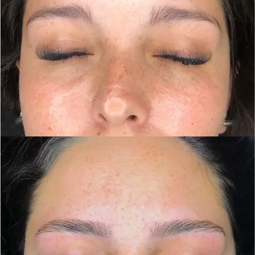 Tratamiento y restauración de cejas 