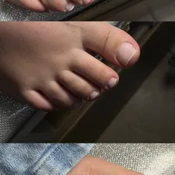Pedicura 