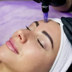 Full face (dermaplaning + microneedling)