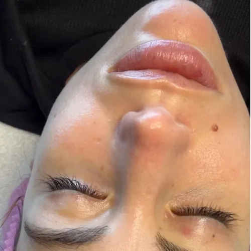 Limpieza Profunda + Peeling + Dermaplaning