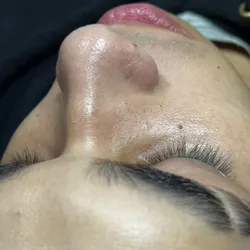 •Primeros cuidados• Limpieza facial en piel de adolescente 