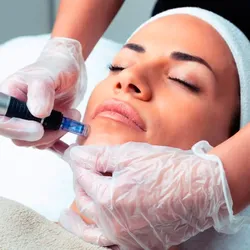 Dermapen classic