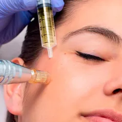 Dermapen + Exosomas