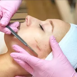 Dermaplaning