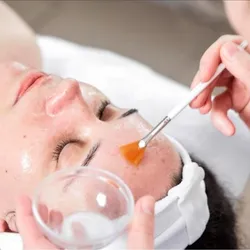 Peeling químico