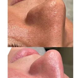 HIGIENE PURE PEPTIDE