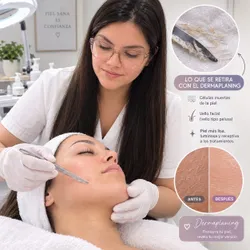 LIMPIEZA PROFUNDA SKIN GLOW (dermaplaning + peeling)