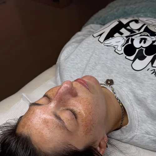 Limpieza Facial Profunda 