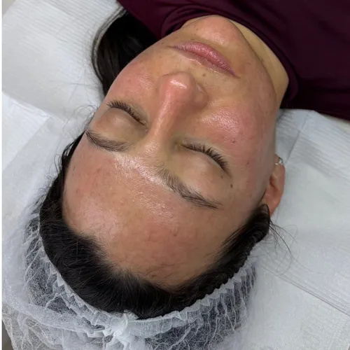 Limpieza Facial Profunda+Escote+Cuello