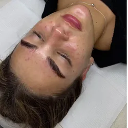 Limpieza Facial Profunda+Perfilado+Lamindao