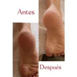 Podologia sencilla o médica completaleta