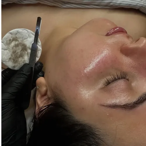 Tratamiento de limpieza facial profunda con DERMAPLANING. EI