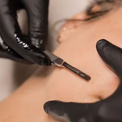 Limpieza facial mas dermaplaning 