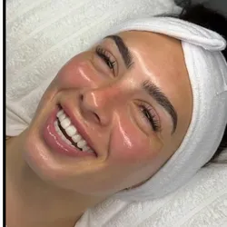 Limpieza Facial Profunda Premium 🔥NEW ❤️🏆
