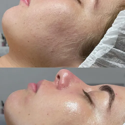 HIGIENE + DERMAPLANING / GLOW CARE, de ZENIA ATELIER