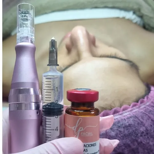 Microneedling, de Glow Lab