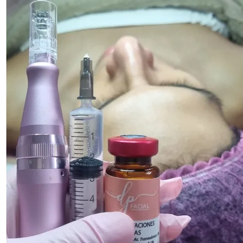 Microneedling Importado 🇰🇷, de Glow Lab