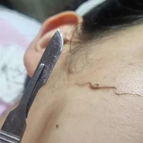Limpieza + Dermaplaning, de Glow Lab