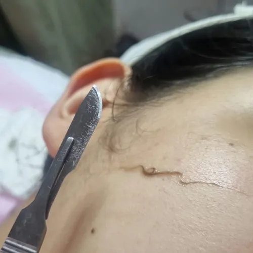 Dermaplaning + Peeling, de Glow Lab
