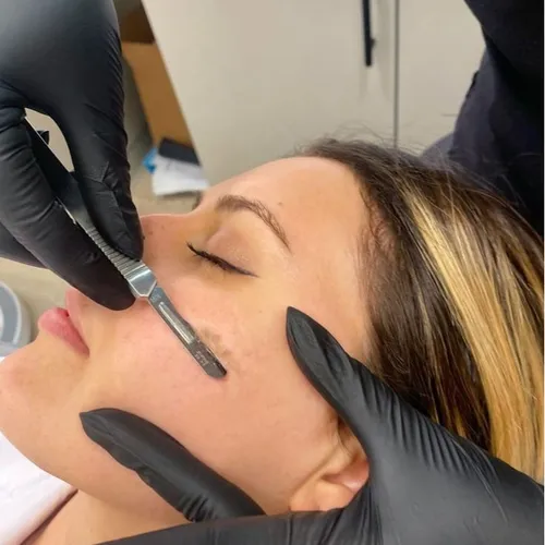 Dermaplaning (inc. limpieza facial prof.), de Softskin
