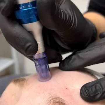 Exosomas, de Softskin