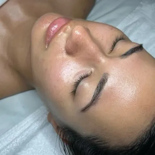 Dermapen + Dermaplaning, de Softskin