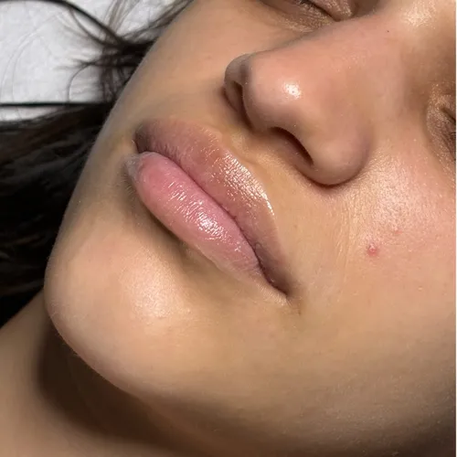 Hydralips, de Mora Beauty Studio